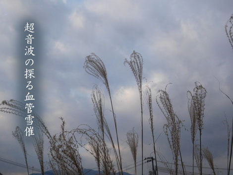 yukimoyoi20190110.jpg